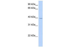 IQCD antibody used at 1 ug/ml to detect target protein. (IQCD anticorps  (N-Term))