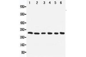 Anti-Apoptosis repressor with CARD antibody, Western blotting Lane 1: SMMC Cell Lysate Lane 2: A549 Cell Lysate Lane 3: U87 Cell Lysate Lane 4: HELA Cell Lysate Lane 5: MCF-7 Cell Lysate Lane 6: Rat Liver Tissue Lysate (NOL3 anticorps  (Middle Region))