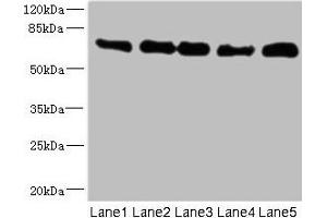 Western blot All lanes: NUMB antibody at 0. (NUMB anticorps  (AA 532-651))