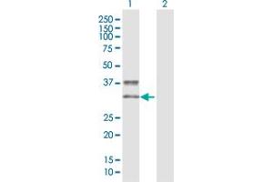 Western Blot analysis of KIR2DS3 expression in transfected 293T cell line by KIR2DS3 MaxPab polyclonal antibody. (KIR2DS3 anticorps  (AA 1-304))