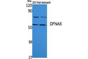 Western Blotting (WB) image for anti-Deafness, Autosomal Dominant 5 (DFNA5) (Internal Region) antibody (ABIN3187614)