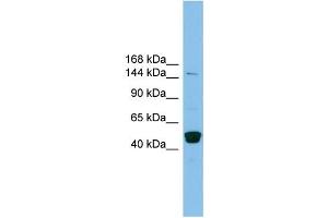 WB Suggested Anti-PRDM10 Antibody Titration: 0. (PRDM10 anticorps  (Middle Region))