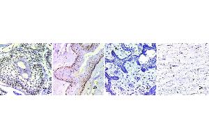 Staining of odontogenic tumors and odontogenic cyst: (1a) shows H and E stained SMA at x400, (1b) shows H and E stained OKC at x400, (1c) shows H and E stained AF at x400, (1d) shows H and E stained OM at x400. (BMP4 anticorps  (C-Term))