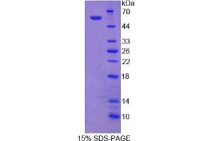 Image no. 1 for Nicastrin (NCSTN) (AA 35-534) protein (His tag) (ABIN6238439) (Nicastrin Protein (NCSTN) (AA 35-534) (His tag))
