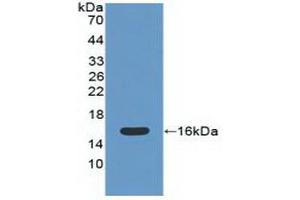 Detection of Recombinant CAT, Mouse using Polyclonal Antibody to Catalase (CAT) (Catalase anticorps  (AA 32-157))