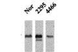 Image no. 1 for anti-Calcium/calmodulin-Dependent Protein Kinase II beta (CAMK2B) (pThr286), (Thr287) antibody (ABIN466897) (CAMK2B anticorps  (pThr286, Thr287))