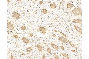 Immunohistochemistry analysis of paraffin-embedded mouse brain using MBP Polyclonal Antibody at dilution of 1:300. (MBP anticorps)