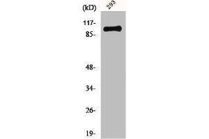 Western Blot analysis of 293 cells using mGluR-4 Polyclonal Antibody (Metabotropic Glutamate Receptor 4 anticorps  (C-Term))