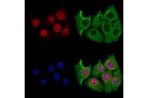 SLFN11 Antibody staining HepG2 cells by IF/ICC. (SLFN11 anticorps  (N-Term))