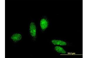 Immunofluorescence of monoclonal antibody to MTA3 on HeLa cell. (MTA3 anticorps  (AA 416-515))