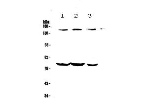 Western blot analysis of KCNH1 using anti-KCNH1 antibody . (KCNH1 anticorps)