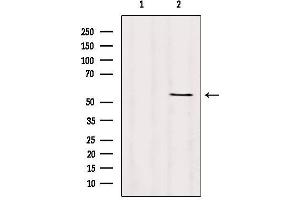 Western blot analysis of extracts from Hybridoma cells, using TMPRSS4 Antibody. (TMPRSS4 anticorps  (Internal Region))