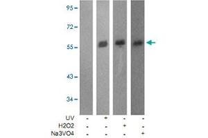 Western blot analysis of extracts from JK cells using LCK (phospho Y505) polyclonal antibody . (LCK anticorps  (pTyr505))