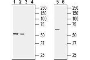 Western blot analysis of rat brain (lanes 1 and 3), mouse brain (lanes 2 and 4), (1:200) and human brain neuroblastoma SH-SY5Y cell line lysates (lanes 5 and 6), (1:600): - 1, 2, 5. (PACSIN1 anticorps  (Intracellular))