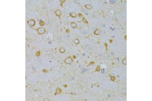 Immunohistochemistry of paraffin-embedded rat brain using TSHR Antibody.