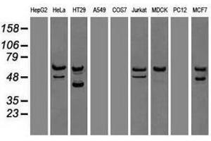 Image no. 6 for anti-Checkpoint Kinase 2 (CHEK2) antibody (ABIN1497498) (CHEK2 anticorps)