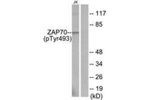 Western blot analysis of extracts from Jurkat cells, using ZAP-70 (Phospho-Tyr493) Antibody. (ZAP70 anticorps  (pTyr493))