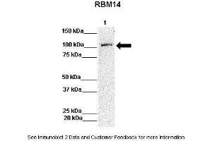 Lanes:   Lane 1: 50ug Hela Lysate  Primary Antibody Dilution:   1:1000  Secondary Antibody:   Anti-rabbit-HRP  Secondary Antibody Dilution:   1:10,000  Gene Name:   RBM14  Submitted by:   Archa Fox, University of Western Australia (RBM14 anticorps  (N-Term))