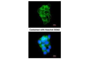 ICC/IF Image Immunofluorescence analysis of methanol-fixed A431, using PPFIBP2, antibody at 1:200 dilution. (PPFIBP2 anticorps  (Center))
