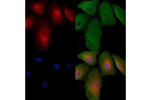 ABIN6264924 and ABIN6279466 staining  cells by IF/ICC.