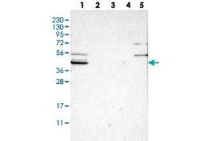 Western blot analysis of Lane 1: RT-4, Lane 2: U-251 MG, Lane 3: Human Plasma, Lane 4: Liver, Lane 5: Tonsil with SLCO2B1 polyclonal antibody .