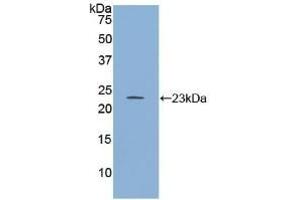 Detection of Recombinant RGS4, Human using Polyclonal Antibody to Regulator Of G Protein Signaling 4 (RGS4) (RGS4 anticorps  (AA 38-205))