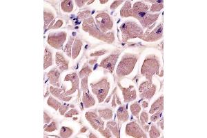 A staining MYBPC3 in human heart tissue sections by Immunohistochemistry (IHC-P - paraformaldehyde-fixed, paraffin-embedded sections).