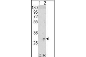 Western blot analysis of ITM2A (arrow) using rabbit polyclonal ITM2A Antibody (N-term) (ABIN390731 and ABIN2841002). (ITM2A anticorps  (N-Term))