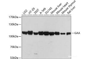 Western blot analysis of extracts of various cell lines using GAA Polyclonal Antibody at dilution of 1:1000. (GAA anticorps)