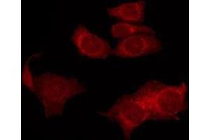 ABIN6277475 staining HUVEC by IF/ICC. (FSHR anticorps  (Internal Region))