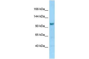 WB Suggested Anti-Diaph2 Antibody Titration: 1. (DIAPH2 anticorps  (C-Term))