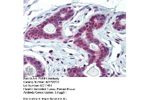 Immunohistochemistry with Human Breast tissue at an antibody concentration of 5. (FUBP1 anticorps  (Middle Region))