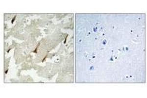 Immunohistochemistry analysis of paraffin-embedded human brain tissue using GPRIN2 antibody.