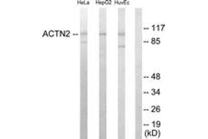 Western blot analysis of extracts from HepG2/HeLa/HuvEc cells, using Actinin alpha-2/3 Antibody. (ACTN2/3 anticorps  (AA 31-80))
