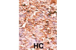 Immunohistochemistry (IHC) image for anti-HIST1H3B3 (pSer10) antibody (ABIN2933004) (HIST1H3B3 (pSer10) anticorps)