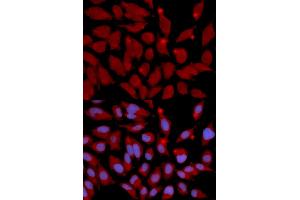 Immunofluorescence analysis of U2OS cells using DNMT3A antibody (ABIN5971096). (DNMT3A anticorps)