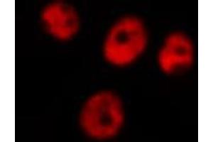 anti-Ubiquitin Protein Ligase E3 Component N-Recognin 5 (UBR5) (N-Term) antibody