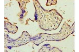 Immunohistochemistry of paraffin-embedded human placenta tissue using ABIN7176647 at dilution of 1:100 (ZNF265 anticorps  (AA 1-320))