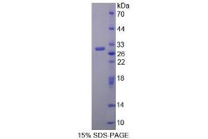 SDS-PAGE (SDS) image for Vasorin (Vasn) (AA 298-539) protein (His tag) (ABIN3209960) (Vasn Protein (AA 298-539) (His tag))