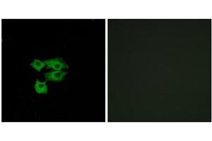 Immunofluorescence analysis of A549 cells, using LY6E antibody. (LY6E anticorps  (Internal Region))