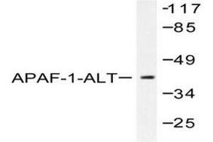 Image no. 2 for anti-Apoptotic Peptidase Activating Factor 1 (APAF1) antibody (ABIN265312) (APAF1 anticorps)