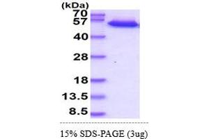 SDS-PAGE (SDS) image for Tumor Necrosis Factor Receptor Superfamily, Member 10b (TNFRSF10B) (AA 56-210) (Active) protein (hIgG-His-tag) (ABIN7529387)