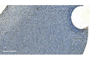 IHC analysis of H Cadherin/CDH13 using anti-H Cadherin/CDH13 antibody (ABIN7600095).