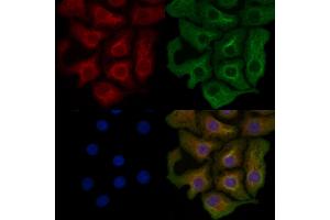 ABIN6259403 and ABIN6276173 staining Hela cells by IF/ICC.