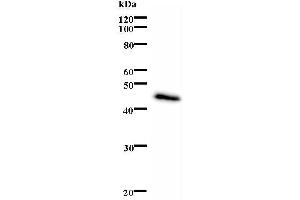 Western Blotting (WB) image for anti-Excision Repair Cross-Complementing Rodent Repair Deficiency, Complementation Group 6 (ERCC6) antibody (ABIN932472) (ERCC6 anticorps)