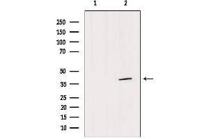 Western blot analysis of extracts from HepG2, using SFXN4 Antibody. (Sideroflexin 4 anticorps  (N-Term))