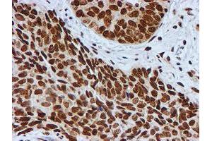 Image no. 9 for anti-Fragile X Mental Retardation 1 (FMR1) antibody (ABIN1498287)