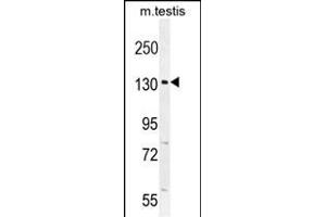 CIC Antibody (N-term) (ABIN654662 and ABIN2844358) western blot analysis in mouse testis tissue lysates (35 μg/lane). (CIC anticorps  (N-Term))