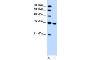 SLC25A29 antibody used at 1. (SLC25A29 anticorps  (C-Term))