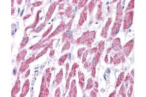ACAT1 antibody was used for immunohistochemistry at a concentration of 4-8 ug/ml. (ACAT1 anticorps  (Middle Region))